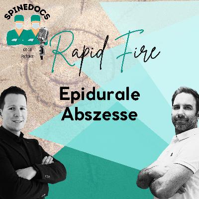 Rapid Fire: Epidurale Abszesse