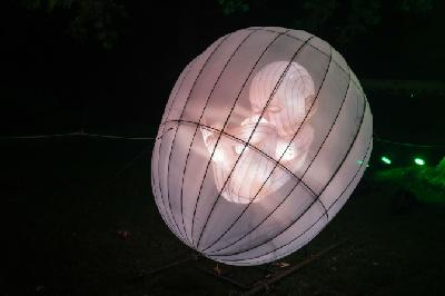 El útero artificial que podría salvar bebés prematuros El útero artificial que podría salvar bebés prematuros