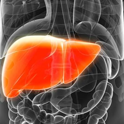 Ep.1 T.2 - RM para as lesões hepáticas! Ep.1 T.2 - RM para as lesões hepáticas!