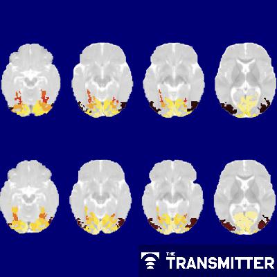 Infant visual system categorizes common objects by 2 months of age