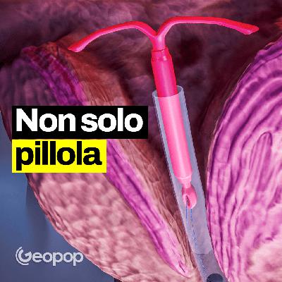 331 - Come funzionano i metodi contraccettivi femminili e maschili e quali sono i più efficaci 331 - Come funzionano i metodi contraccettivi femminili e maschili e quali sono i più efficaci