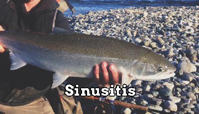 Always in Pursuit Episode Seventeen: Sinusitis Always in Pursuit Episode Seventeen: Sinusitis