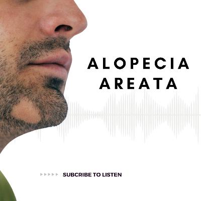 Alopecia Areata
