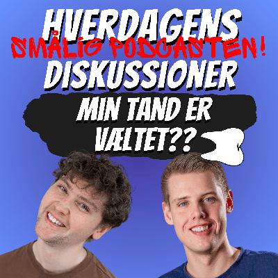 Min tand er åbenbart væltet 🦷