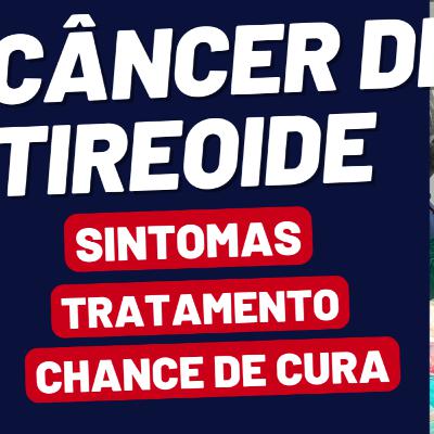 Câncer de Tireoide: Sintomas, Tratamento e Chances de Cura Câncer de Tireoide: Sintomas, Tratamento e Chances de Cura
