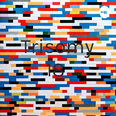 Trisomy 18/ Edwards Syndrome