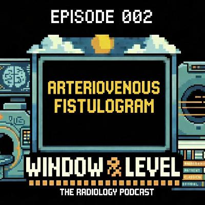 Arteriovenous Fistulas: When They Fail & How to Save Them | Ep. 002 Arteriovenous Fistulas: When They Fail & How to Save Them | Ep. 002