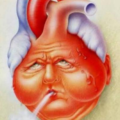 Insuficiencia cardiaca