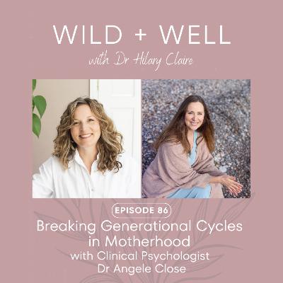 Episode 86 - Breaking Generational Cycles in Motherhood with Clinical Psychologist Dr Angele Close