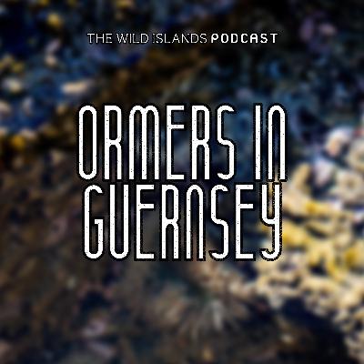 Omers in Guernsey | Episode Five