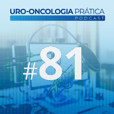 Uro-Oncologia Prática 81 - Toxicidades tardias da radioterapia no tratamento do Câncer de Próstata Uro-Oncologia Prática 81 - Toxicidades tardias da radioterapia no tratamento do Câncer de Próstata