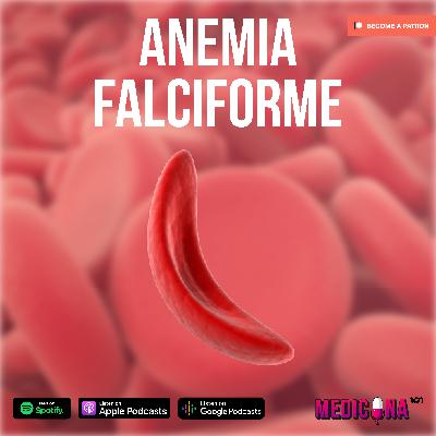 11. Anemia Falciforme