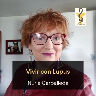 151. Cómo es vivir con Lupus, Nuria Carballeda