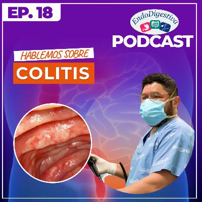 Colitis, síntomas y tratamiento