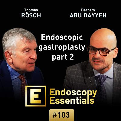 Endoscopic gastroplasty part 2: Preparation and initiation Endoscopic gastroplasty part 2: Preparation and initiation
