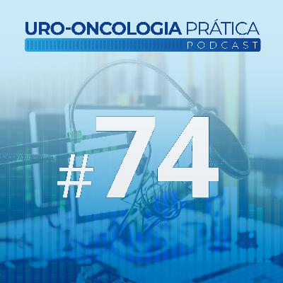 Uro-Oncologia Prática 74 - Uso do ctDNA para o Câncer de Bexiga Localizado