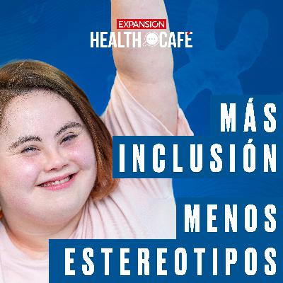 Síndrome de Down, lo que nadie te cuenta