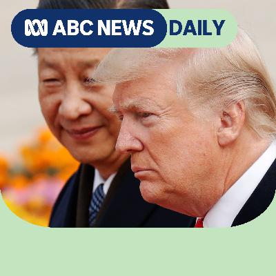 Who wins when Trump meets China’s Xi Jinping? Who wins when Trump meets China’s Xi Jinping?
