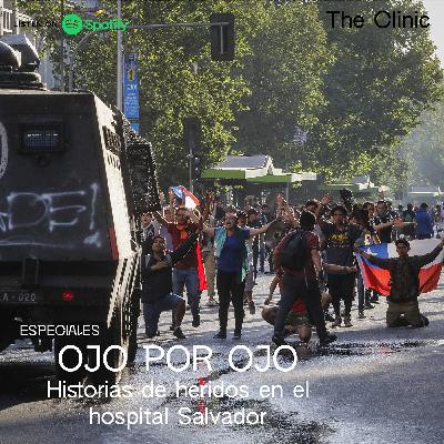 Ojo por ojo