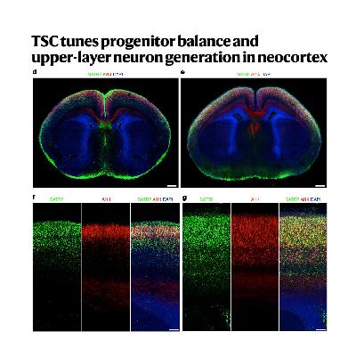 335-TSC调控祖细胞平衡与人类皮层发育
