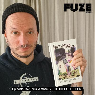 Episode 152 - THE HIRSCH EFFEKT