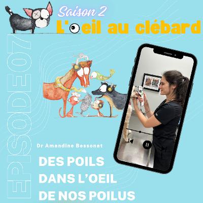 Des poils dans l'oeil de nos poilus Des poils dans l'oeil de nos poilus