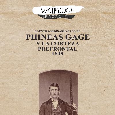 Ep #4: El hijo de Elon Musk, Ensayo clínico religioso y el caso de Phineas Gage | weirdoc podcast. Ep #4: El hijo de Elon Musk, Ensayo clínico religioso y el caso de Phineas Gage | weirdoc podcast.