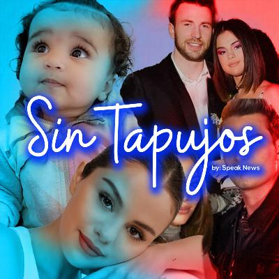 ¿Por qué ha cambiado tanto la cara de Selena Gomez? - SIN TAPUJOS T1.E7.