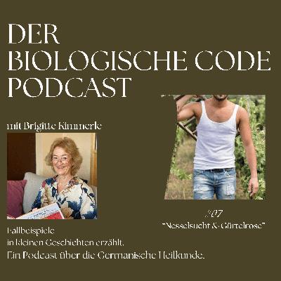 #7 - Nesselsucht & Guertelrose