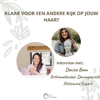 Is er een link tussen onze darmen en haar en huidklachten? Interview met Denise, orthomoleculair darmspecialist