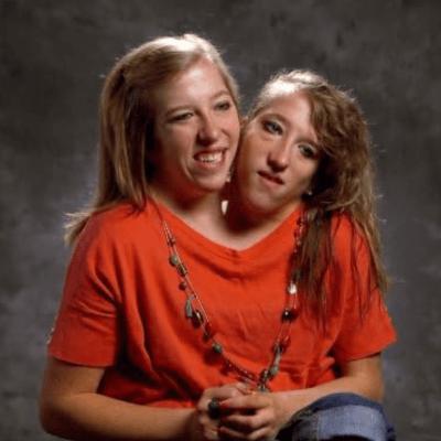 Abby and Brittany Hensel double troubles,  phony Mel Owens,  Bruce Willis wildness and Selena Gomez!