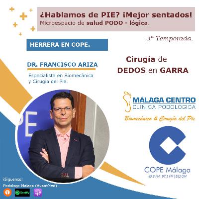 Cirugía de dedos en garra en, ¿Hablamos de PIE? ¡Mejor sentados! 31 x 03 |Microespacio de salud podo-LÓGICA (30/07/2025)
