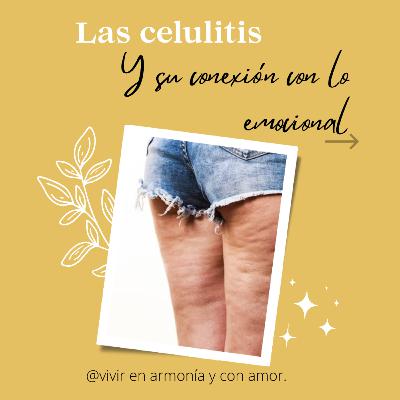 Las celulitis y su conexión con lo emocional 😌