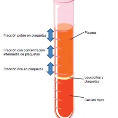 Importancia de la terapia celular(Plasma Rico en Plaquetas) en medicina regenerativa