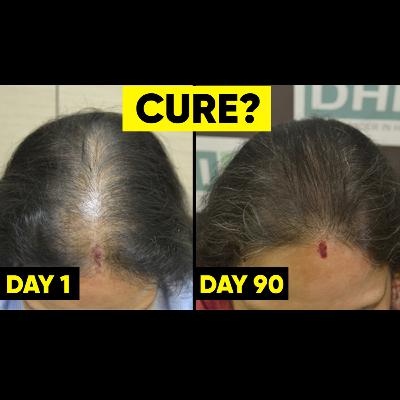 How to Stop Hair Fall and Grow Hair Faster Naturally (Doctor Advice)