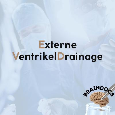 Externe Ventrikeldrainage