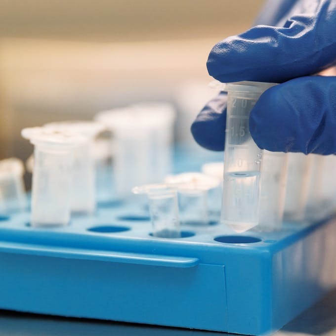 The OPTISMILE Podcast 107 - Saliva Testing and DNA Diagnostics episode artwork