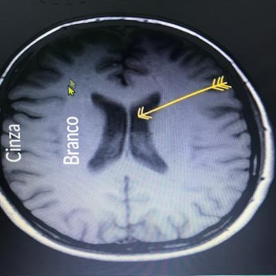 Ressonância magnética
