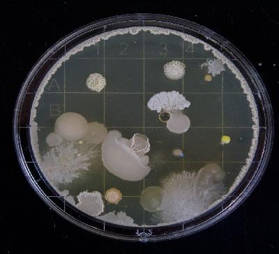 Episode 6: Bugs, Drugs & Antibiotic Stewardship in Vermont