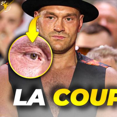 Tyson FURY déjà BLESSÉ face à Usyk...C'est TERRIBLE !