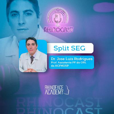 Slit SEG | Dr. Jose Luiz Rodrigues Slit SEG | Dr. Jose Luiz Rodrigues
