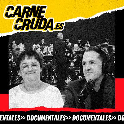 No es tan raro tener una enfermedad rara (CARNE CRUDA #1627) No es tan raro tener una enfermedad rara (CARNE CRUDA #1627)