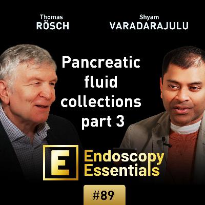 Drainage of pancreatic fluid collections: (3) Stenting and aftercare