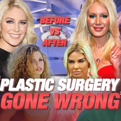 Modern Women Life Cycle: Lip Filler, Botox and BBLs | Pearl Daily