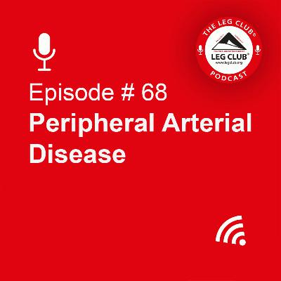 Peripheral Arterial Disease