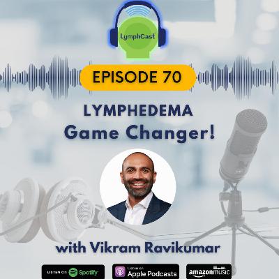 Can Compression Technology Prevent Chronic Swelling? | LymphCast Ep. 70