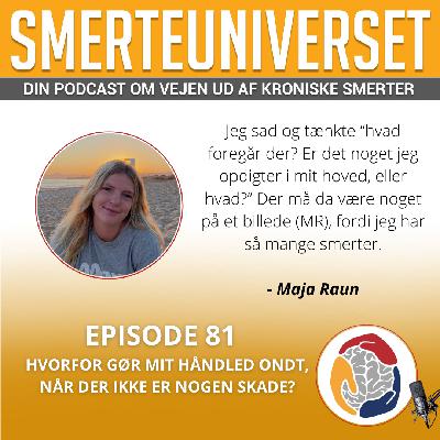 Episode 81 – Hvorfor gør mit håndled ondt, når der ikke er nogen skade? Episode 81 – Hvorfor gør mit håndled ondt, når der ikke er nogen skade?