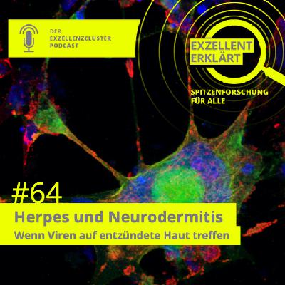 Herpes und Neurodermitis – Wenn Viren auf entzündete Haut treffen