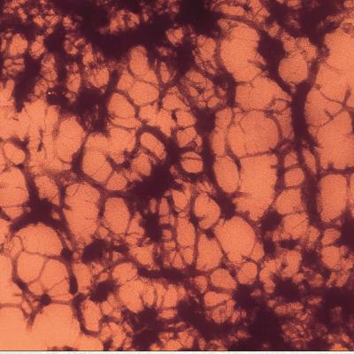Chromatin Structure and Its Effects on Transcription( CMB part 11)
