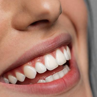 Ano novo, sorriso novo: cuidados essenciais com a saúde bucal